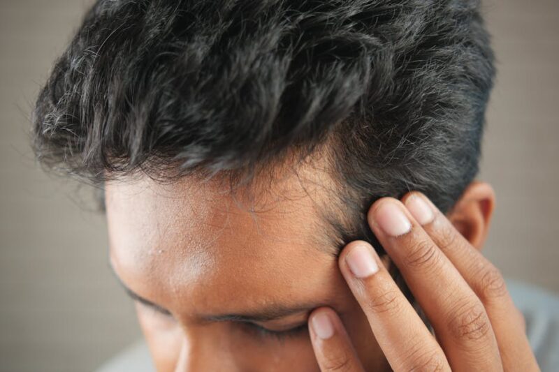 The Comprehensive Guide to Hair Transplant: Everything You Need to Know