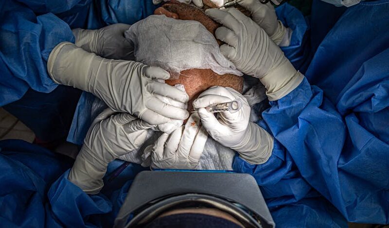 The Comprehensive Guide to Hair Transplant Procedures