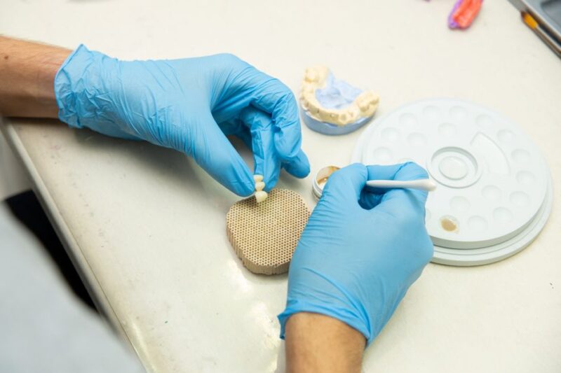 ¿Cuánto cuestan los implantes dentales en 2023?